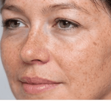 Before fractional