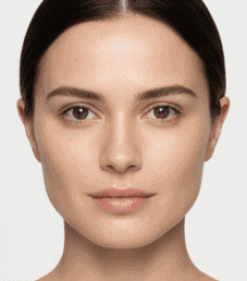 Before Botox