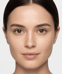 After Botox