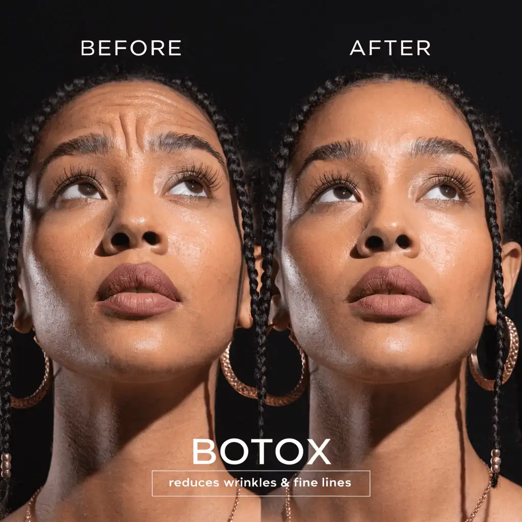 medspa botox