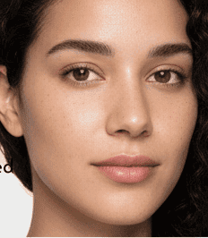 After microneedling