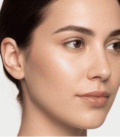 Before microneedling